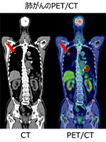 pet-ct02