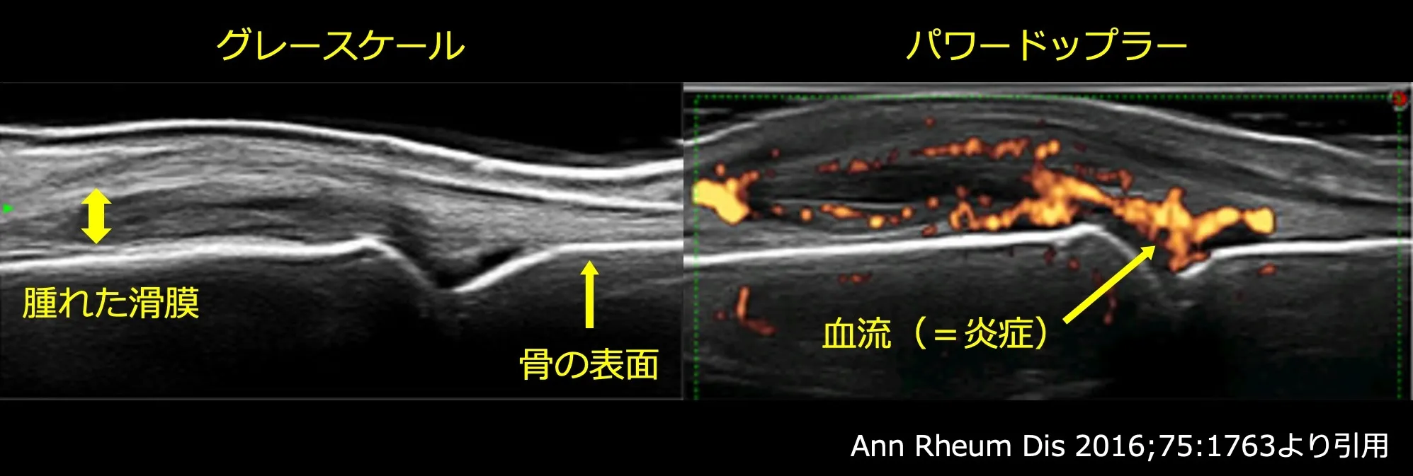 エコー画像