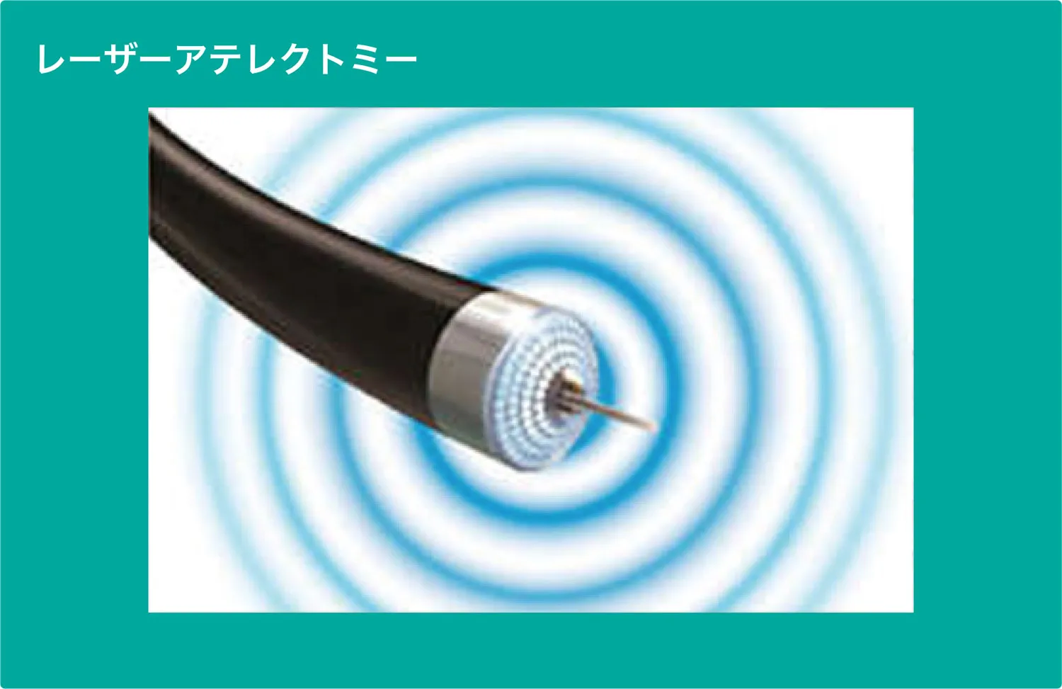 循環器内科-レーザーアテレクトミー