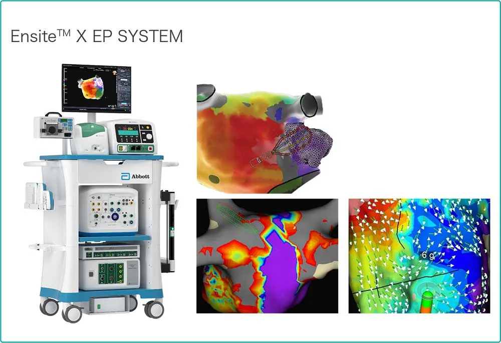 循環器内科-3D-mapping-system①