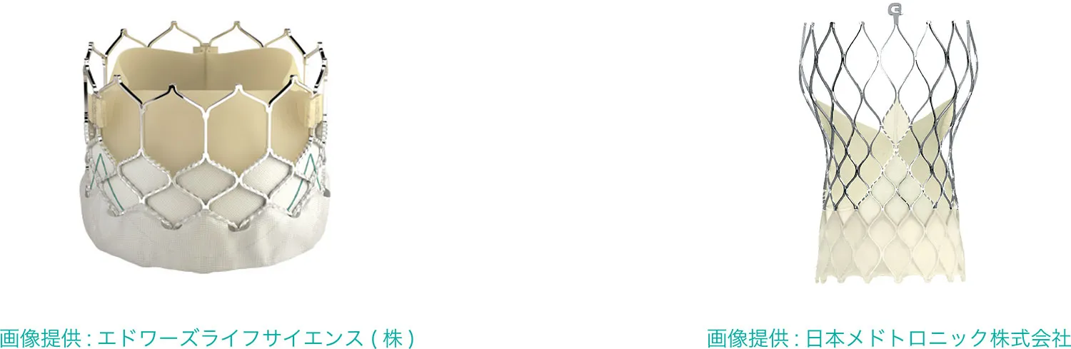 循環器内科-循環器内科-TAVI②