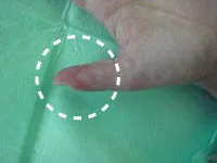 整形外科ー上肢グループ①