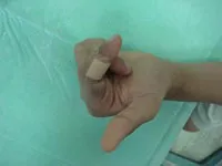 整形外科ー上肢グループ③