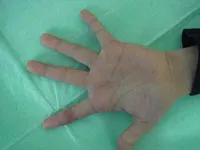 整形外科ー上肢グループ④