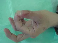 整形外科ー上肢グループ②