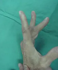 整形外科ー上肢グループ⑥