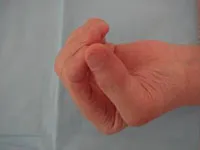 整形外科ー上肢グループ⑭