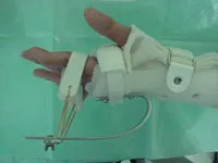整形外科ー上肢グループ⑯