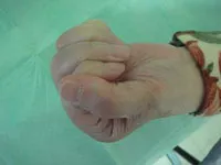 整形外科ー上肢グループ⑲