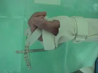 整形外科ー上肢グループ⑰