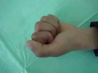 整形外科ー上肢グループ⑤