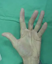 整形外科ー上肢グループ⑦