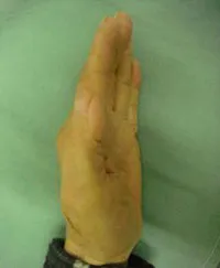 整形外科ー上肢グループ⑧